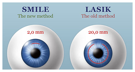 3 Cách chữa cận thị từ nhẹ tới nặng